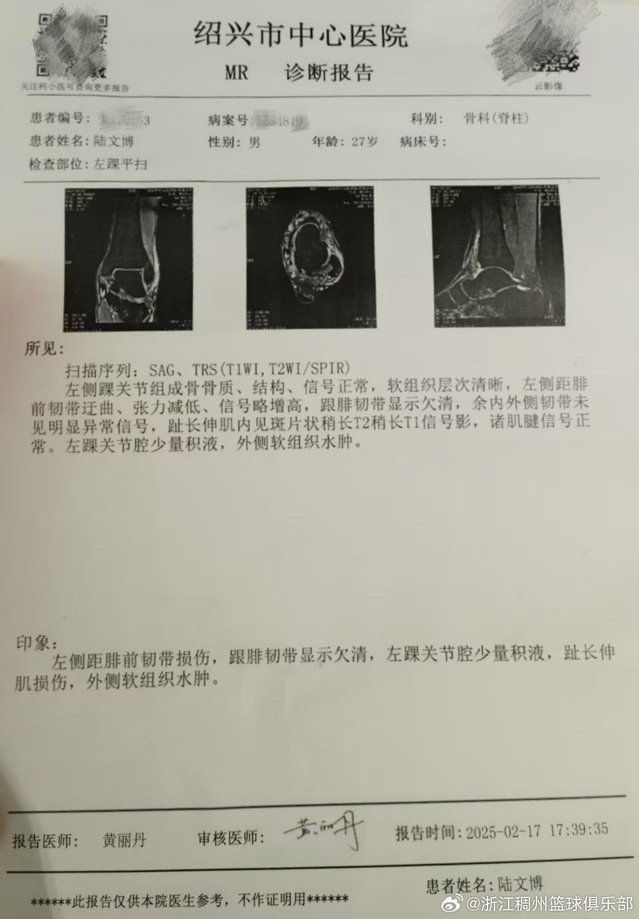 种特殊形式